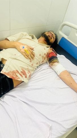 A truck loaded with bricks hit a car, two injured
