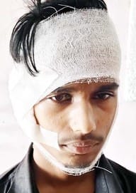 A teenager's ear was cut off and thrown away near Puwaiyan police station
