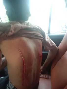 The friend along with his friends attacked the youth with a cutter