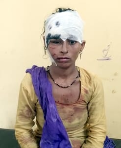 Mother, son and a seven-year-old innocent child were attacked by a dog
