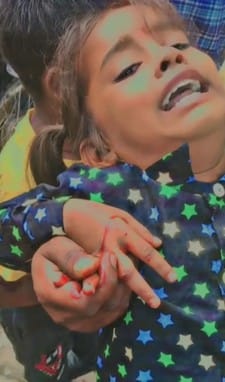 A dog bit a girl's hand and leg in the tehsil premises