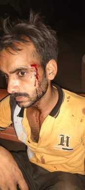 Sticks were used against speeding of pickup truck, seven injured