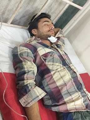 House damaged due to lightning in Fangyar village, youth injured