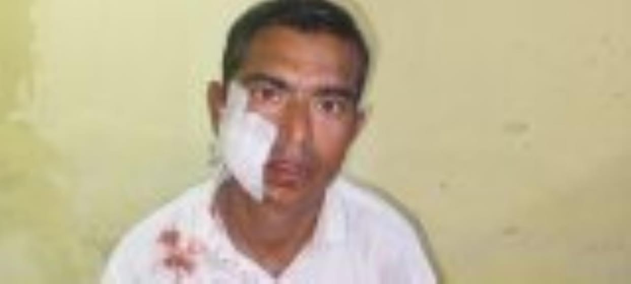 Monkey attacked a hawker riding a bike