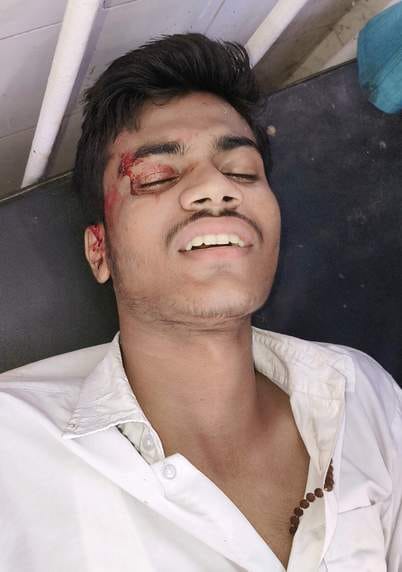 Three students injured in collision between bike and scooty