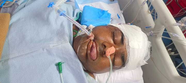 Policeman hit on DME, injured