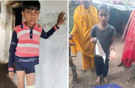 हमले में घायल बच्चे