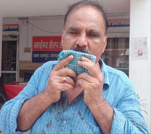 Teachers exchanged blows, two injured