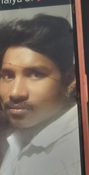 Injured painter dies in Chandigarh Medical College