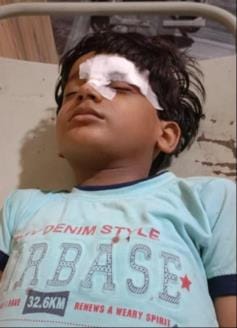 A child playing in the street was injured and critical after an electric pole fell on him