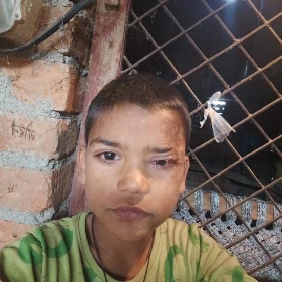 Bike collides with bicycle, student dies, two injured