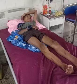 Wound on the mind... Silent Pawan survived but could not return to his world