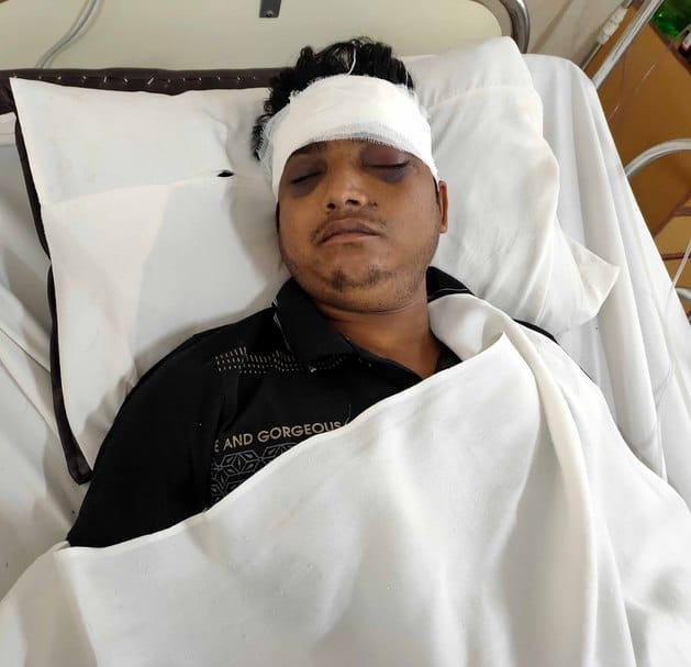 Sandhya shifted from ventilator to ICU