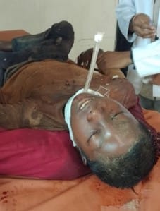 A large part of the throat was cut, government doctors saved the teenager's life