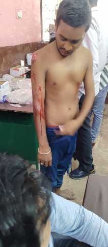 A tiger pounced on a young man, farmers chased him away and saved his life