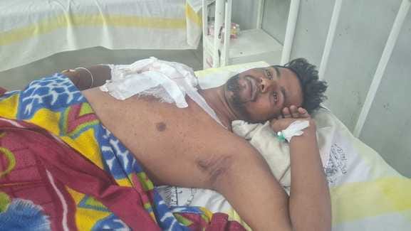 rohtas bihar news: person was shot in dispute, three people injured, rohtas police investigation, sasaram news