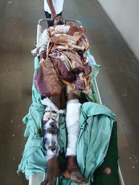 A young man's both legs were broken after being attacked with a stick, a case has been filed against the accused
