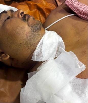 Flour mill operator attacked with knife
