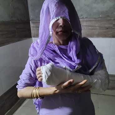 Monkey terror in Harra Nagar Panchayat, woman injured