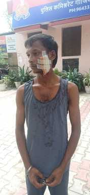 Protesting against a fight outside the house, a young man was injured by hitting with scissors