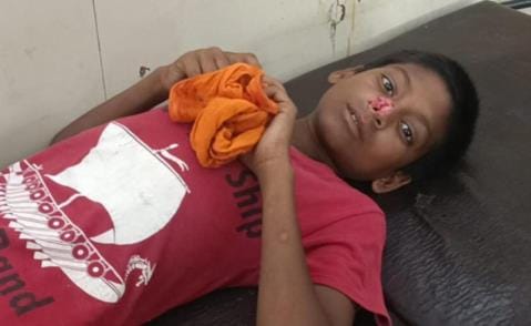 Child injured and critical after dog attack