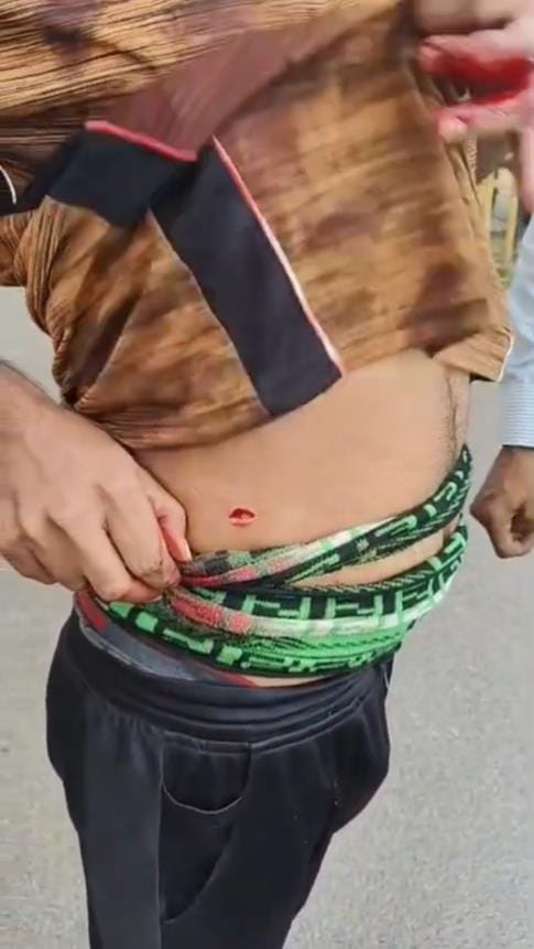 Two friends attacked with sharp weapon, case registered