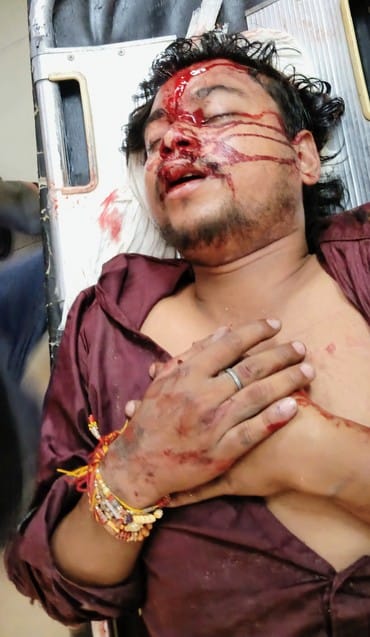 Uncle and nephew riding a bike injured after being hit by an unknown vehicle