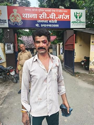 History sheeter attacked home guard with iron rod and injured him
