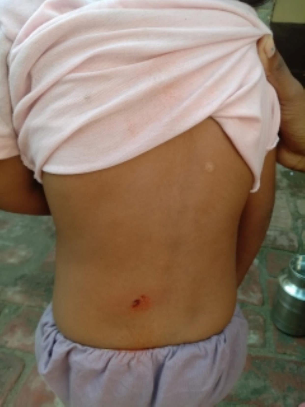 Monkey menace increased in Devrala, innocent attacked, people worried