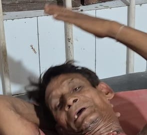accused of spraying petrol and setting fire