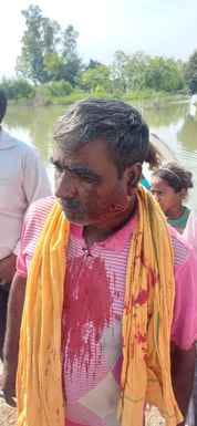 After a dispute with his wife, the young man shot his father-in-law on the temple
