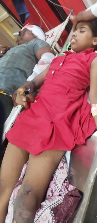 Girl burnt by 11 thousand volt current, condition critical