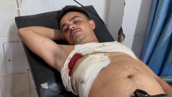 A young man was shot due to enmity, his condition is critical
