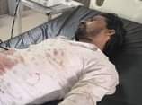 When he reached home late, his wife stabbed him in the stomach with scissors, referred