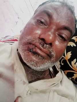 Monkeys create havoc in Bhimwapar, many villagers injured