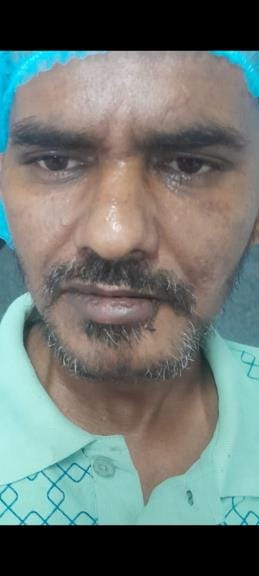 The Young Man Who Came For A Checkup After The Accident Is Missing From Pgi – Chandigarh News