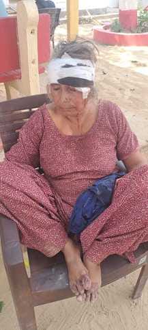 Two injured in a fight after a quarrel between mother-in-law and daughter-in-law