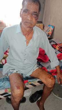 Dogs mauled an old man in Muniarpur, his condition is serious