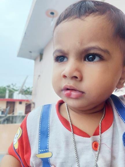 Monkeys attacked two innocent children, leaving them bleeding.