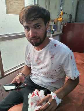Two groups clashed at the medical college, leaving one injured.