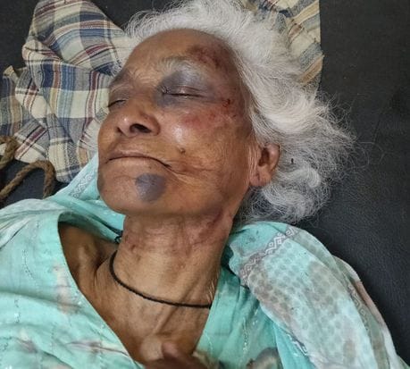 Old woman beaten, gold earrings and cash snatched