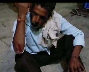 Bike rider narrowly escapes leopard attack