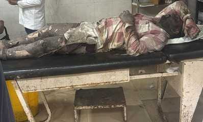 Four workers were suddenly burnt in a furnace while working in a textile factory.