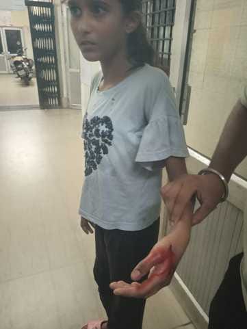 10-year-old girl attacked by dogs in Prem Vihar, referred to Delhi