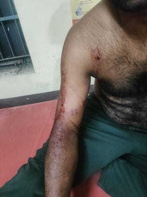 Miscreants opened fire on a bike rider, case registered against 10