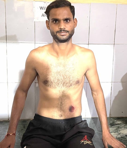 Youth beaten up and shot at for not paying Rs 500