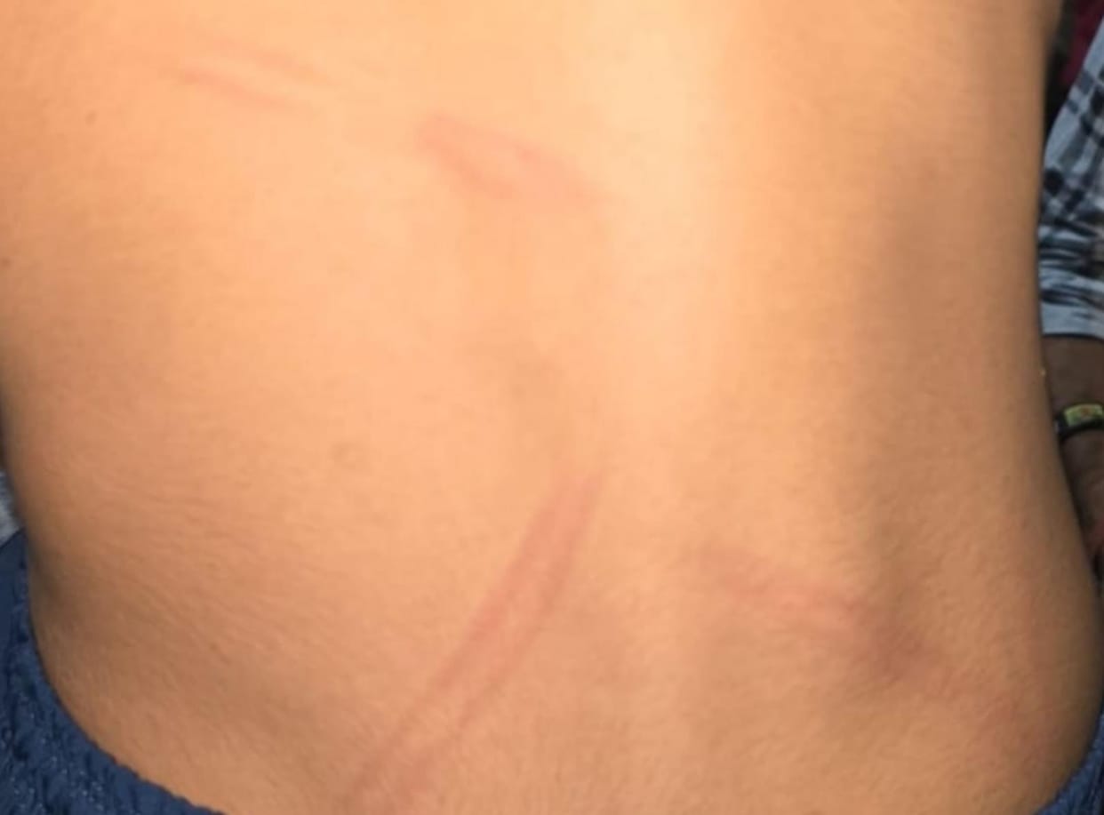 student beaten in school