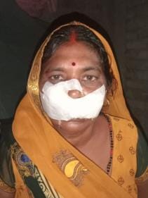 The jackal returned home after treatment and his fear persisted.