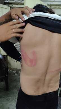 Two youths accused of assault arrested