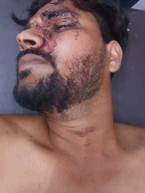 Murderous attack on Durga Puja committee president, two arrested